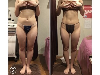 エスプレッソ(espresso,)/【全身痩身12回】3ヶ月で-5.7kg