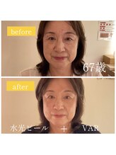 スパ 香炉/GUINOTVAR＋ピーリング