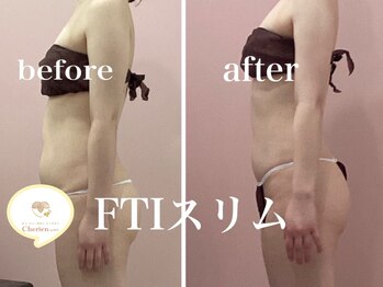 シェリアン バイ アイビー(Cherien by IVY)/痩身No.1 FTIスリム