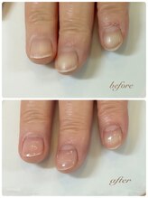 ソネル(SONEL)/ハンドケア