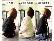 整体院 爽良/【札幌/大通り】頭痛改善