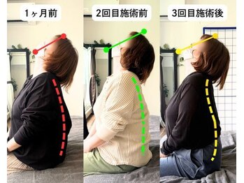 整体院 爽良/【札幌/大通り】頭痛改善