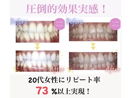 エクシアホワイトニング 姫路店の写真