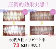 エクシアホワイトニング 姫路店