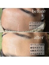 デザインファム(DESIGN FAM)/フェイスワックス☆