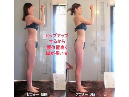 痩身 セル脂肪専門 スタイルデザインの写真