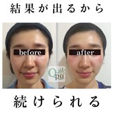 キュープ 日本橋店(Qpu)