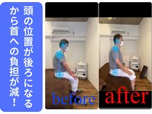広島ミライエ整体院(広島MIRAIE整体院)/背中の丸さを良くしていく
