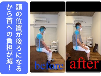 広島ミライエ整体院(広島MIRAIE整体院)/背中の丸さを良くしていく