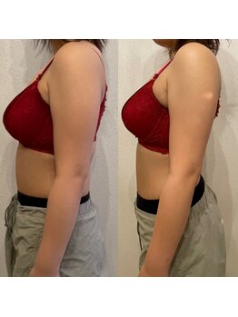 ハル 水戸市(HaRu)/