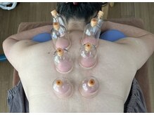 ケア工房 美いずの雰囲気（新メニュー【カッピングコース】）