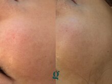 グレイスリリー 久屋 栄(grace lily)/