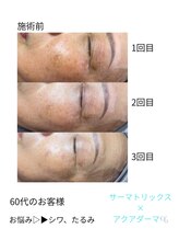 リル(Rire)/Before→After