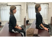 恵比寿西口整体院/腰痛でお悩みの60代女性