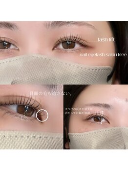 クレー(Klee)/ラッシュリフト