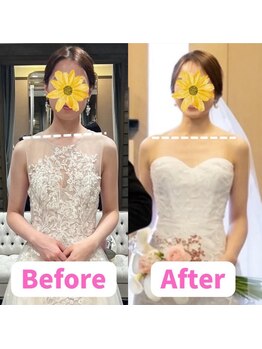 すみれ鍼灸整骨院/神戸 ブライダル美容整体