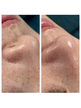 リノルーア(Linolua)/