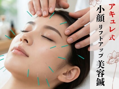 アキュレ(Acure)の写真