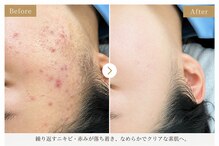 サロン ド ラジュニール(Salon de Rajeunir)