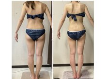 ビボディラボ 海老名店(美Body Labo)の雰囲気（ブライダルエステや全身痩せ、痩せたい部分を集中施術【2ヶ月】）