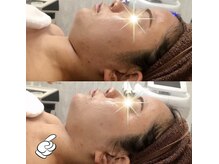 トータルエステサロン エステアンドメイク 錦糸町/二重アゴ改善