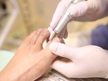 巻き爪補正店 北千住店の写真/ガサガサの踵や硬くなったタコ、爪でお悩みの方へ◎なかなか改善しないお悩みは豊富な経験と技術で改善！