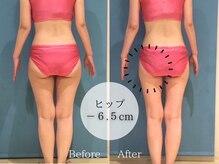 ピュアエステ ブリアント 松戸店/お客様の結果［松戸］