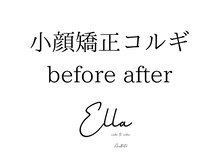 エラ(ella)/小顔矯正コルギ