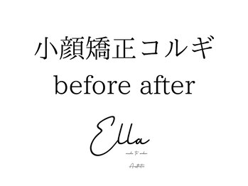 エラ(ella)/小顔矯正コルギ