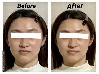 ショウフェイスデザイン(Sho Face Design)/《全身整体》ビフォーアフター