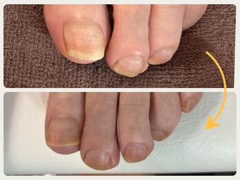 グランボヌール(grand bonheur)/【フット爪切り♪】