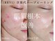 インディビューティー 六本木店(inde beauty)の写真