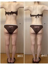 アンフィニ(infini)/短期集中コース全身5回（2ヶ月)