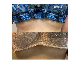 サロンツキ(salon tuki)/【バストアップ】症例★