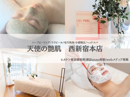 天使の艶肌の写真