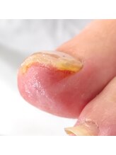 001 新横浜/強い変形でもOK