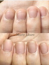 マリーロール 天王寺店(Marie Laure)/自爪育成/深爪矯正/ネイルケア