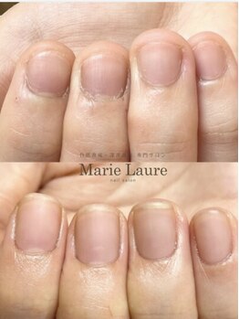 マリーロール 天王寺店(Marie Laure)/自爪育成/深爪矯正/ネイルケア