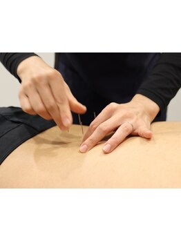 鍼灸施術を受けたい