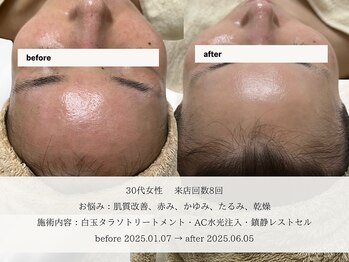 エメ(aimer)/SkinCare《肌管理・エイジング》