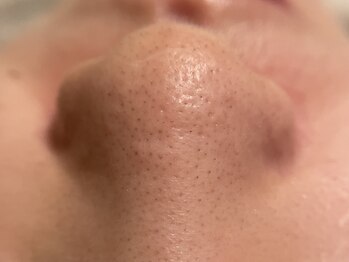 リセットプラス(Reset+)/