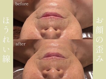 健志接骨院/πテラピー造顔メソッド