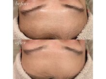 イロドリ(IRODORI)/くすみが抜けてトーンが均一に！