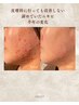 人気＆満足度NO.1【肌質分析カウンセリング】原因を見つけてスタート！