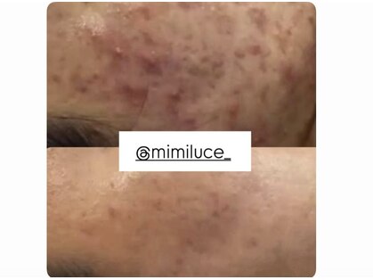 ミミルーチェ 中目黒(mimiluce)の写真
