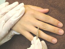 フィールアーズ(feel ars)/指の脱毛◎1本1本処理☆美容電気