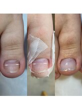 レア(Le'a)/フットトラブルカウンセリング