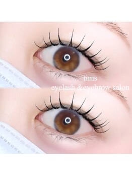 ティムス(tims)/パリエク120本