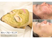 スリースリー(THREE THREE)の雰囲気（【肌育ハーブピーリング】繰り返すニキビ・皮脂・お悩みの方に◎）