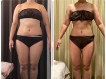 美容整体ウェリナ あま甚目寺院/.【ダイエットbefore→after】